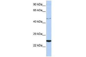 CRLF1 antibody used at 1 ug/ml to detect target protein.