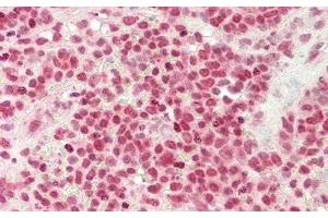 Detection of DNASE1 in Human Spleen Tissue using Monoclonal Antibody to Deoxyribonuclease I (DNASE1) (DNASE1 antibody  (AA 19-259))