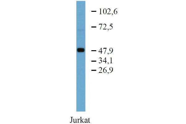 TFG antibody