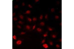 Immunofluorescent analysis of INTS6 staining in Hela cells. (INTS6 antibody)