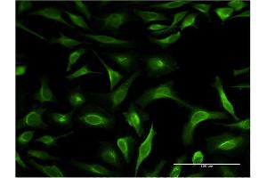 Immunofluorescence of monoclonal antibody to S100P on HeLa cell. (S100P antibody  (AA 1-69))