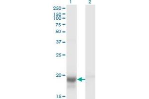 Western Blot analysis of SKP1 expression in transfected 293T cell line by SKP1A monoclonal antibody (M01), clone 1H8. (SKP1 antibody  (AA 53-160))