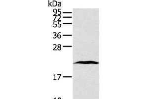 Western Blot analysis of Human lung cancer tissue using TAF10 Polyclonal Antibody at dilution of 1:400 (TAF10 antibody)