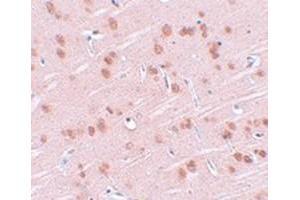 Immunohistochemical staining of rat brain tissue with SYNGR1 polyclonal antibody  at 25 ug/mL dilution.