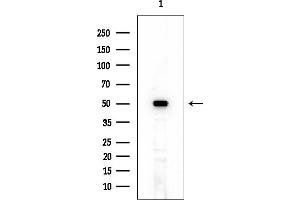 Western blot analysis of lysates from EC304 cells, using CCT4 Mouse Monoclonal Antibody at 1/1000 dilution.