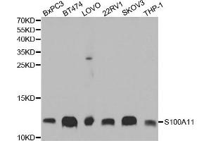 Western Blotting (WB) image for anti-S100 Calcium Binding Protein A11 (S100A11) antibody (ABIN1876674) (S100A11 antibody)