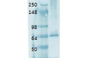 Western Blot analysis of Human thyroid lysate showing detection of Sodium Iodide Symporter protein using Mouse Anti-Sodium Iodide Symporter Monoclonal Antibody, Clone 14F . (SLC5A5 antibody  (AA 468-643) (PerCP))