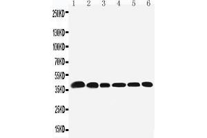 Anti-Nucleophosmin antibody, Western blotting Lane 1: Rat Testis Tissue Lysate Lane 2: Rat Brain Tissue Lysate Lane 3: HELA Cell Lysate Lane 4: U87 Cell Lysate Lane 5: A549 Cell LysateLane6: SMMC Cell Lysate (NPM1 antibody  (N-Term))