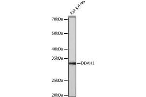 Western blot analysis of extracts of Rat kidney, using DD Rabbit mAb (ABIN7266778) at 1:1000 dilution. (DDAH1 antibody)