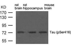 Western blot analysis of extract from rat brain, rat hippocampus and mouse brain using Tau(phospho-Ser416) Antibody. (MAPT antibody  (pSer416))