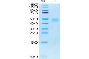 IL21 Receptor Protein (AA 41-254) (His tag)