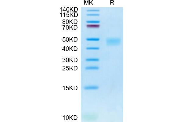 IL21 Receptor Protein (AA 41-254) (His tag)