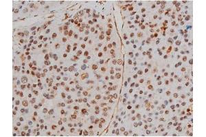 ABIN6267433 at 1/200 staining Human tonsil tissue sections by IHC-P. (Filamin A antibody  (pSer2152))