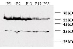 Anti-Zic1 Antibody - Western Blot A similar time course experiment is shown using mouse cerebellum extracts at various time points.