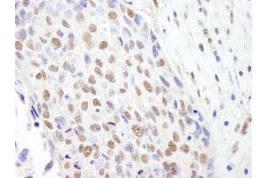 anti-Splicing Factor 3b, Subunit 2, 145kDa (SF3B2) (AA 775-825) antibody