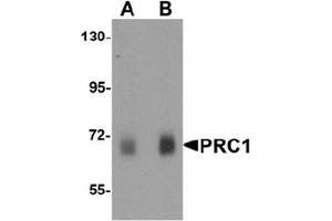 Western blot analysis of PRC1 in human skeletal muscle tissue lysate with Prc1 antibody at (A) 0. (PRC1 antibody  (Middle Region))