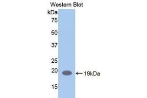 Detection of Recombinant LIFR, Human using Polyclonal Antibody to Leukemia Inhibitory Factor Receptor (LIFR) (LIFR antibody  (AA 692-833))