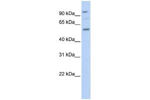 WB Suggested Anti-TEAD1 Antibody Titration: 0. (TEAD1 antibody  (Middle Region))