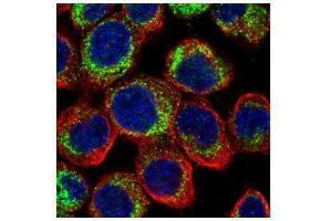 ICC/IF Image Confocal immunofluorescence analysis (Olympus FV10i) of paraformaldehyde-fixed A431, using PDE4D, antibody (Green) at 1:500 dilution. (PDE4D antibody  (C-Term))