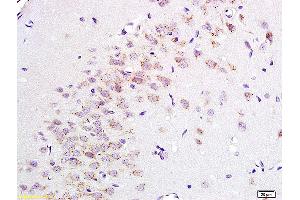 Formalin-fixed and paraffin embedded rat brain tissue labeled with Anti ENKEPHALIN/P-ENK Polyclonal Antibody, Unconjugated (ABIN677633) at 1:200 followed by conjugation to the secondary antibody and DAB staining. (Enkephalin antibody)