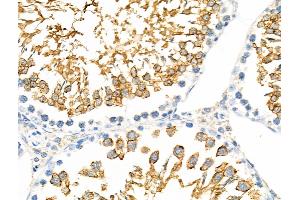 ABIN6257454 and ABIN6275443 at 1/100 staining Rat testis tissue by IHC-P. (RANBP17 antibody  (N-Term))