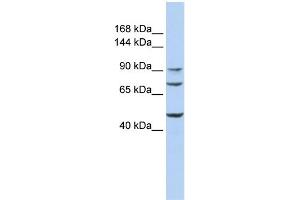 WB Suggested Anti-GALNT5 Antibody Titration:  0. (GALNT5 antibody  (Middle Region))