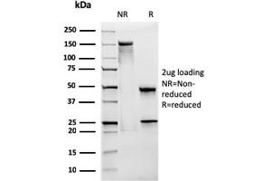 SDS-PAGE Analysis Purified CD28 Mouse Monoclonal Antibody (CB28). (CD28 antibody)