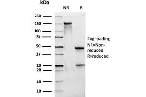 SDS-PAGE Analysis Purified CD28 Mouse Monoclonal Antibody (CB28). (CD28 antibody)