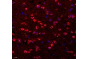 Immunofluorescence of paraffin embedded mouse corpus striatum using Tuba3a (ABIN7076051) at dilution of 1: 600 (400x lens) (Tuba3a antibody)