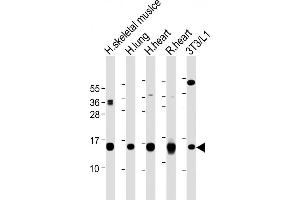 All lanes : Anti-FABP4 Antibody (Y20) at 1:2000-1:8000 dilution Lane 1: Human skeletal muslce lysate Lane 2: Human lung lysate Lane 3: Human heart lysate Lane 4: Rat heart lysate Lane 5: 3T3/L1 whole cell lysate Lysates/proteins at 20 μg per lane. (FABP4 antibody  (AA 1-30))