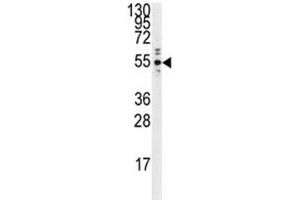 Western blot analysis of PTP1B antibody and Ramos lysate. (PTPN1 antibody)