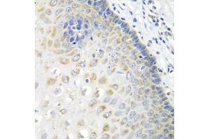 Immunohistochemistry of paraffin-embedded human esophagus using STXBP4 antibody  at dilution of 1:100 (40x lens).