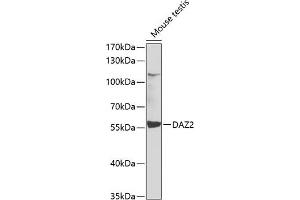 Western blot analysis of extracts of mouse testis, using D antibody (ABIN6127797, ABIN6139413, ABIN6139414 and ABIN6223512) at 1:1000 dilution. (DAZ2 antibody  (AA 1-200))