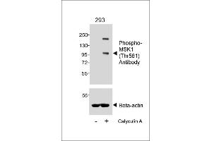 Western blot analysis of lysates from 293 cell line, untreated or treated with Calyculin A, 100nM, 30 min, using Phospho-MSK1 (Thr581) Antibody (upper) or Beta-actin (lower). (MSK1 antibody  (pThr581))