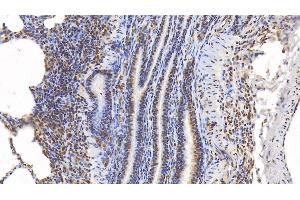 Detection of ERK2 in Porcine Lung Tissue using Monoclonal Antibody to Extracellular Signal Regulated Kinase 2 (ERK2) (ERK2 antibody  (AA 25-360))