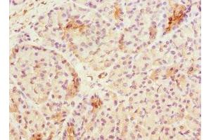 Immunohistochemistry of paraffin-embedded human pancreatic tissue using ABIN7171839 at dilution of 1:100 (ASPSCR1 antibody  (AA 284-553))