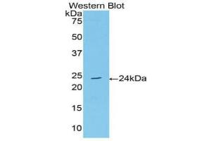 Detection of Recombinant AchE, Human using Polyclonal Antibody to Acetylcholinesterase (ACHE) (Acetylcholinesterase antibody  (AA 377-574))