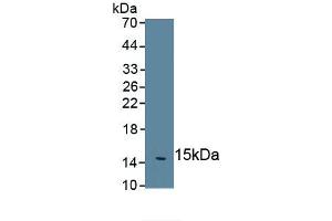 Detection of Recombinant IL5, Human using Monoclonal Antibody to Interleukin 5 (IL5) (IL-5 antibody  (AA 20-134))