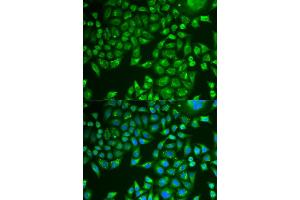 Immunofluorescence analysis of U2OS cells using PNLIP antibody . (PNLIP antibody  (AA 166-465))