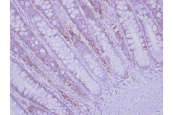 RPLP2 antibody  (Center)