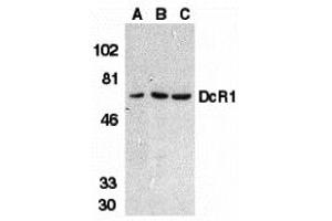 Western Blotting (WB) image for anti-Tumor Necrosis Factor Receptor Superfamily, Member 10c (TNFRSF10C) (2nd Extracellular Domain) antibody (ABIN1030838) (DcR1 antibody  (2nd Extracellular Domain))