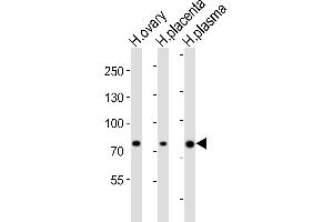 Western blot analysis of lysates from human ovary, human placenta, human plasma tissue lysate (from left to right), using ITGB8 Antibody (Center) (ABIN6244113 and ABIN6577824).