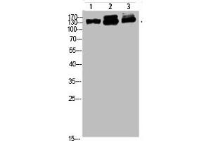 Western blot analysis of 823 293T-UV HELA Cell Lysate, antibody was diluted at 1:1000 (NFAT5 antibody  (AA 1268-1341))