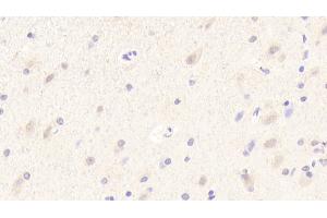 Detection of MOG in Human Cerebrum Tissue using Polyclonal Antibody to Myelin Oligodendrocyte Glycoprotein (MOG)