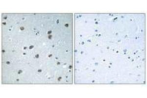 Immunohistochemistry analysis of paraffin-embedded human brain tissue using KLHL29 antibody. (KLHL29 antibody)