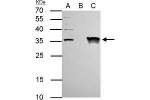 IP Image TFIIE beta antibody immunoprecipitates TFIIE beta protein in IP experiments. (GTF2E2 antibody)