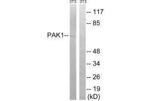Western blot analysis of extracts from 3T3 cells, treated with UV (15 mins), using PAK1 (Ab-204) antibody. (PAK1 antibody  (Ser204))
