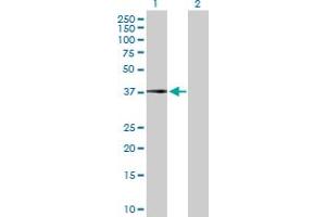Western Blot analysis of CFHR1 expression in transfected 293T cell line by CFHR1 MaxPab polyclonal antibody. (CFHR1 antibody  (AA 1-330))