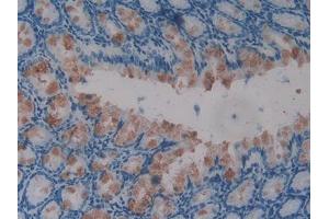 DAB staining on IHC-P; Samples: Mouse Intestine Tissue (GLMN antibody  (AA 294-549))
