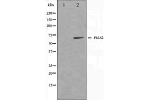 Western blot analysis on COS7 cell lysate using PIAS2 Antibody,The lane on the left is treated with the antigen-specific peptide. (PIAS2 antibody)